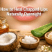 How to Heal Chapped Lips Naturally Overnight: Simple Remedies That Work